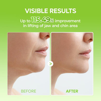 Juno Beauty™ V-Line Lifting Mask Band